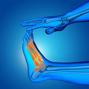 الشد العضلي