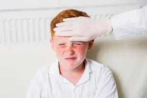 ما هي أعراض الجدري المائي عند الأطفال